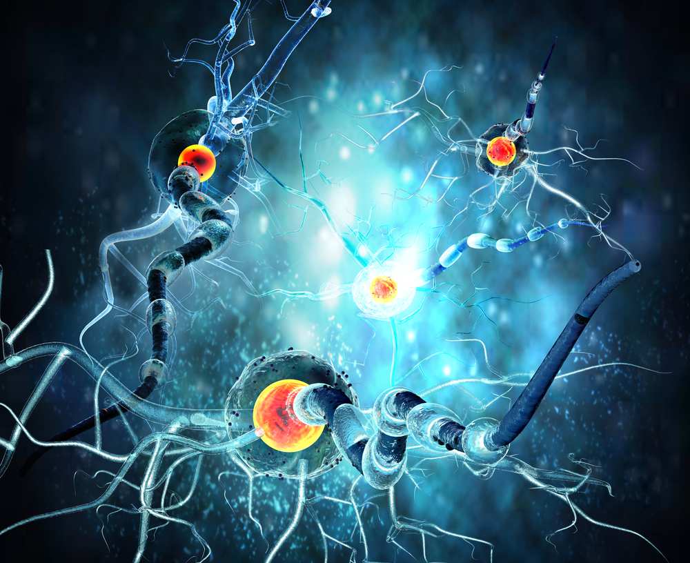 Illustration of multiple sclerosis